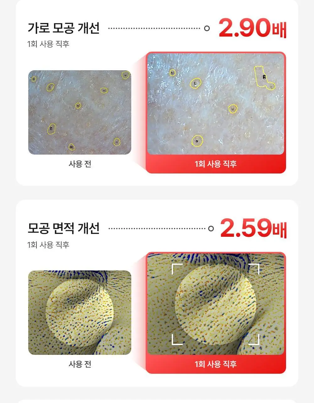 [모공쏙폼] 메디필 레드 락토 콜라겐 클리어 폼 2.0 대용량 300ml 기획 (+해면) 상세페이지 24
